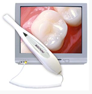 Intraoral camera at Roane Family Dental in West Linn, OR